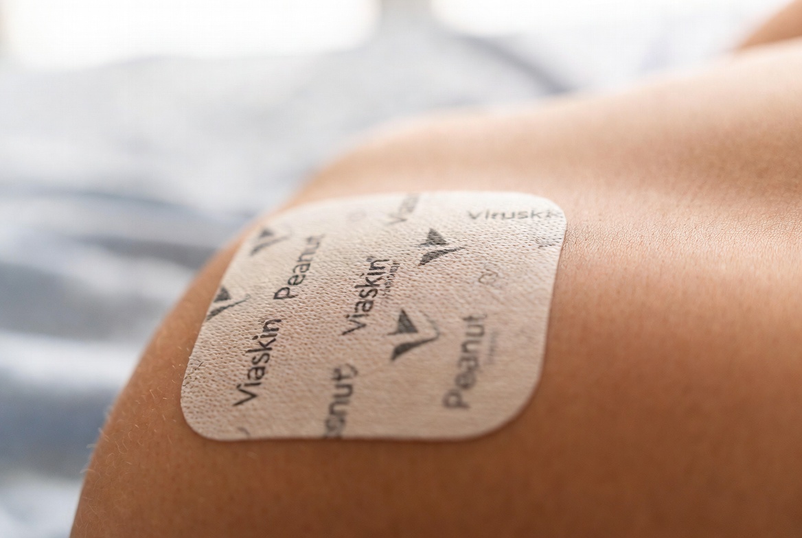 Does epicutaneous immunotherapy hold the key to a breakthrough on allergy treatment by DBV-Technologies?